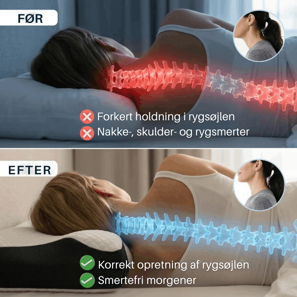 NordicRest™ | Ergonomisk støtte til nakke og skuldre