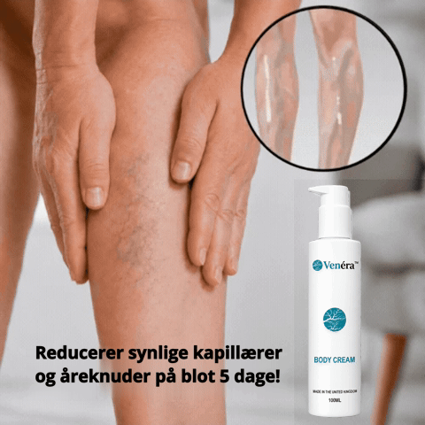 Venéra™ | Reducerer synlige åreknuder på 5 dage