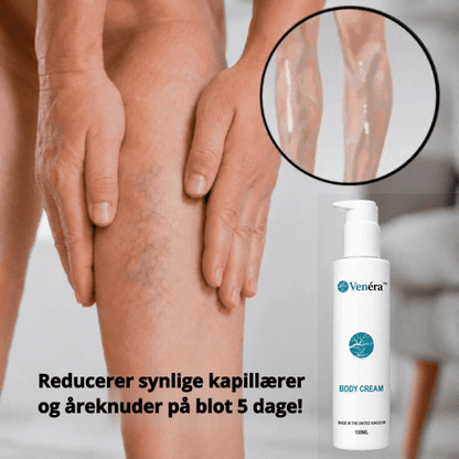 Venéra™ | Reducerer synlige åreknuder på 5 dage