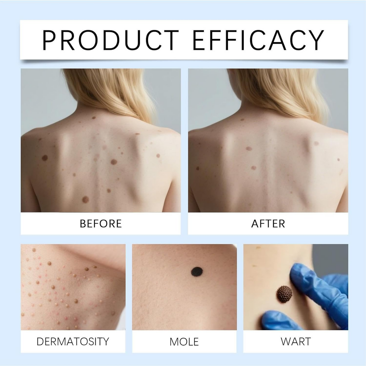 KlarPunkt™ 1+1 GRATIS - Avanceret Klar Hud Forfinende Fornyelse Roller Serum