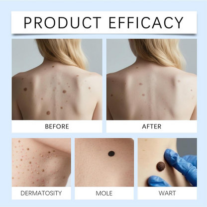 KlarPunkt™ 1+1 GRATIS - Avanceret Klar Hud Forfinende Fornyelse Roller Serum